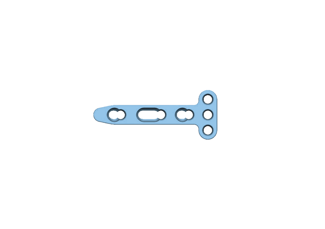 Distal Radius T-Locking Compression Plate-1